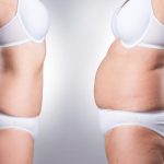 Where to Inject Semaglutide for Weight Loss: Optimal Sites for Semaglutide Injections