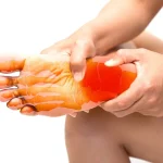 Neuropathy Symptoms