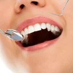 Oral Exams Foundation for Restorations