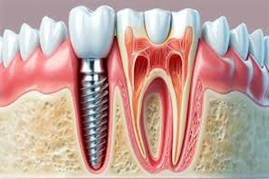 Oral Health