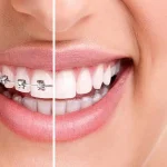 Orthodontics