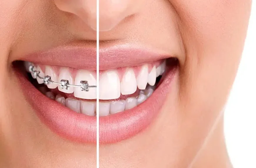 Orthodontics