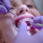 Orthodontic