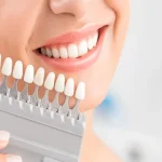Implant Planning Services