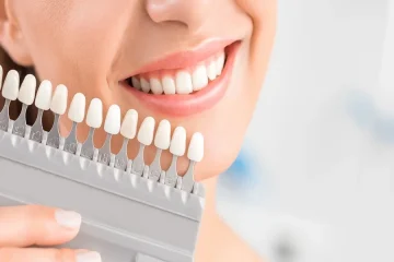 Implant Planning Services