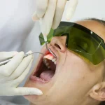 Laser Therapy