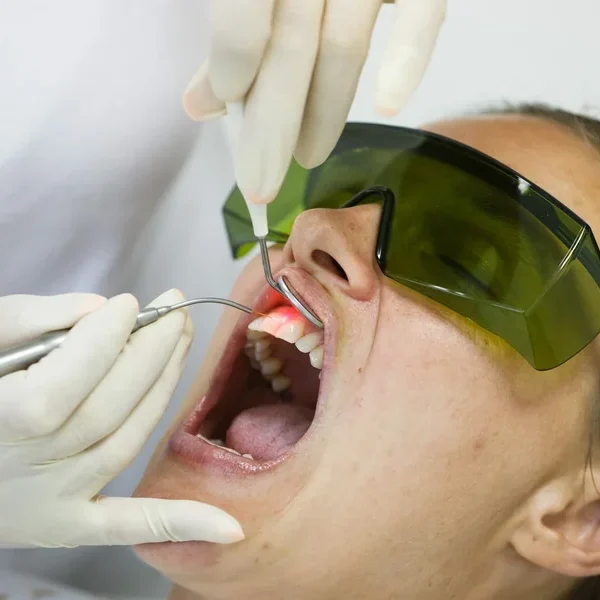 Laser Therapy