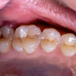 Oral Health Issues